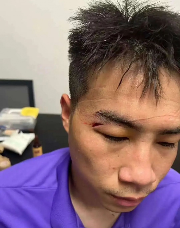 津媒：王献钧两颗门牙被撞断，杨帆眉骨受伤赛后去医院缝针